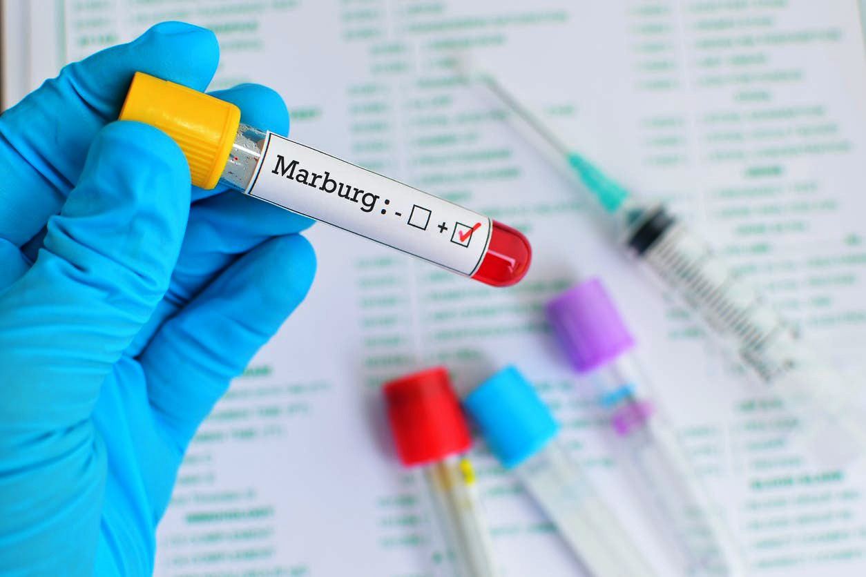 Virus Marburg confirmé au Ghana, le Togo en alerte 